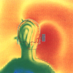 thermische Erw�rmung am Kopf